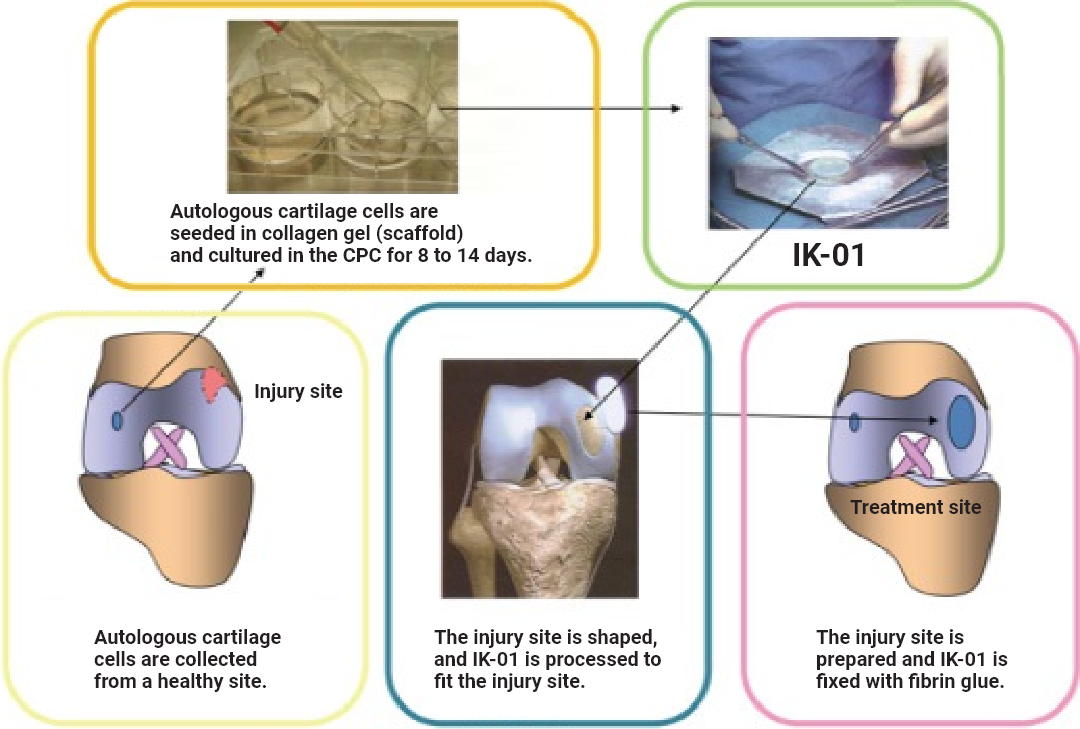 IK-01による膝軟骨の治療戦略