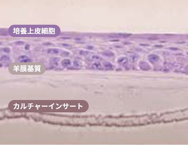 H&E staining image of multiple layers of oral mucosal epithelial cells on an amniotic membrane substrate